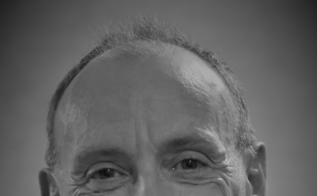 Foto em preto e branco mostra homem calvo, com destaque para seus olhos sorridentes e para a careca com pouco cabelo.