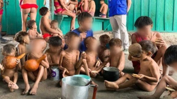 Brasil voltou ao mapa da fome no governo Bolsonaro. Caso de morte e desnutrição de yanomamis são os mais graves, um verdadeiro crime humanitário.